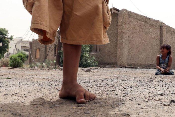 Duas crianças Iemenitas, estropiadas por minas antipessoais, brincam na cidade de Aden, Iémen, uma zona ocupada pelas forças sauditas, com o apoio norte-americano e britânico. 9 de Agosto de 2018 